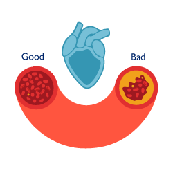 Cholesterol